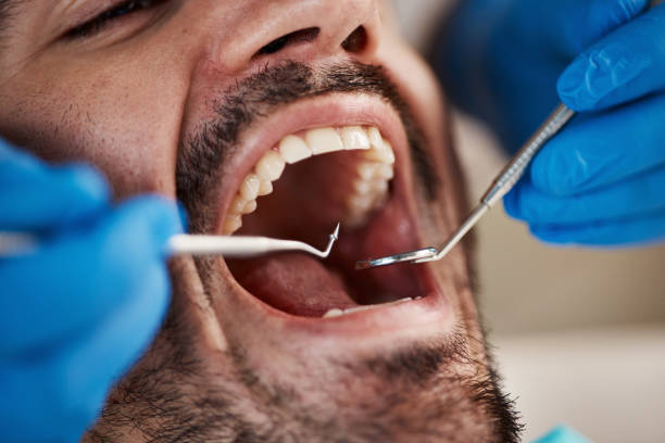 Best Urgent Dental Care for Toothaches in Spry, PA